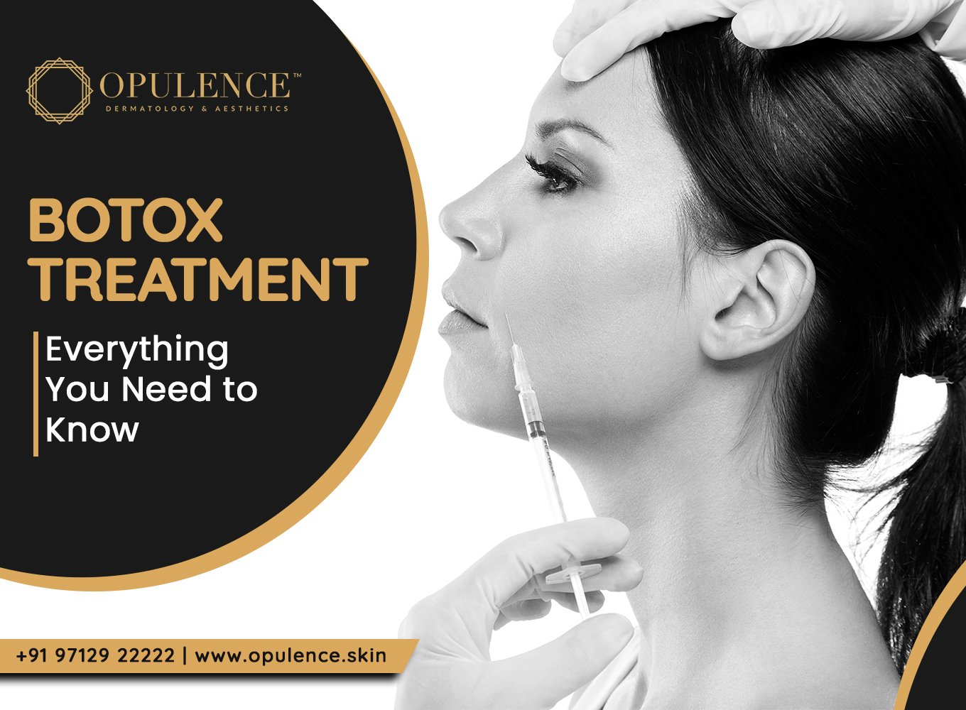 BOTOX, EVERYTHING YOU NEED TO KNOW