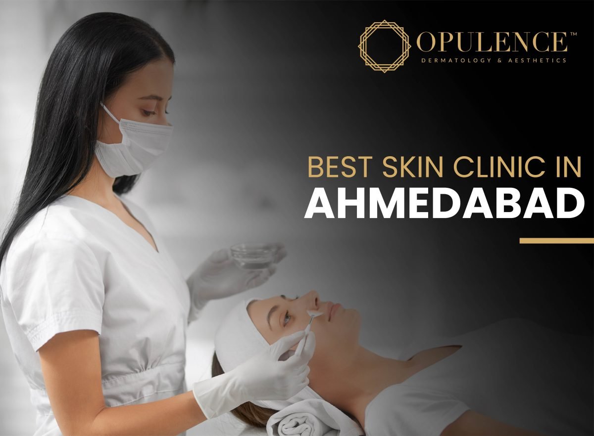 BEST SKIN CLINIC IN AHMEDABAD