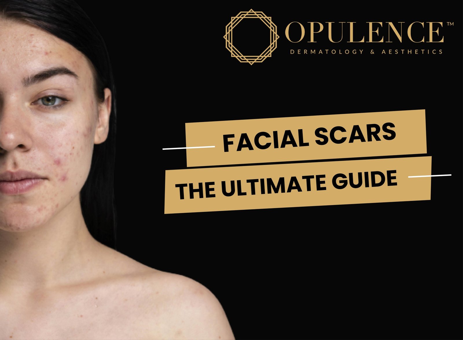 FACIAL SCARS : THE ULTIMATE GUIDE