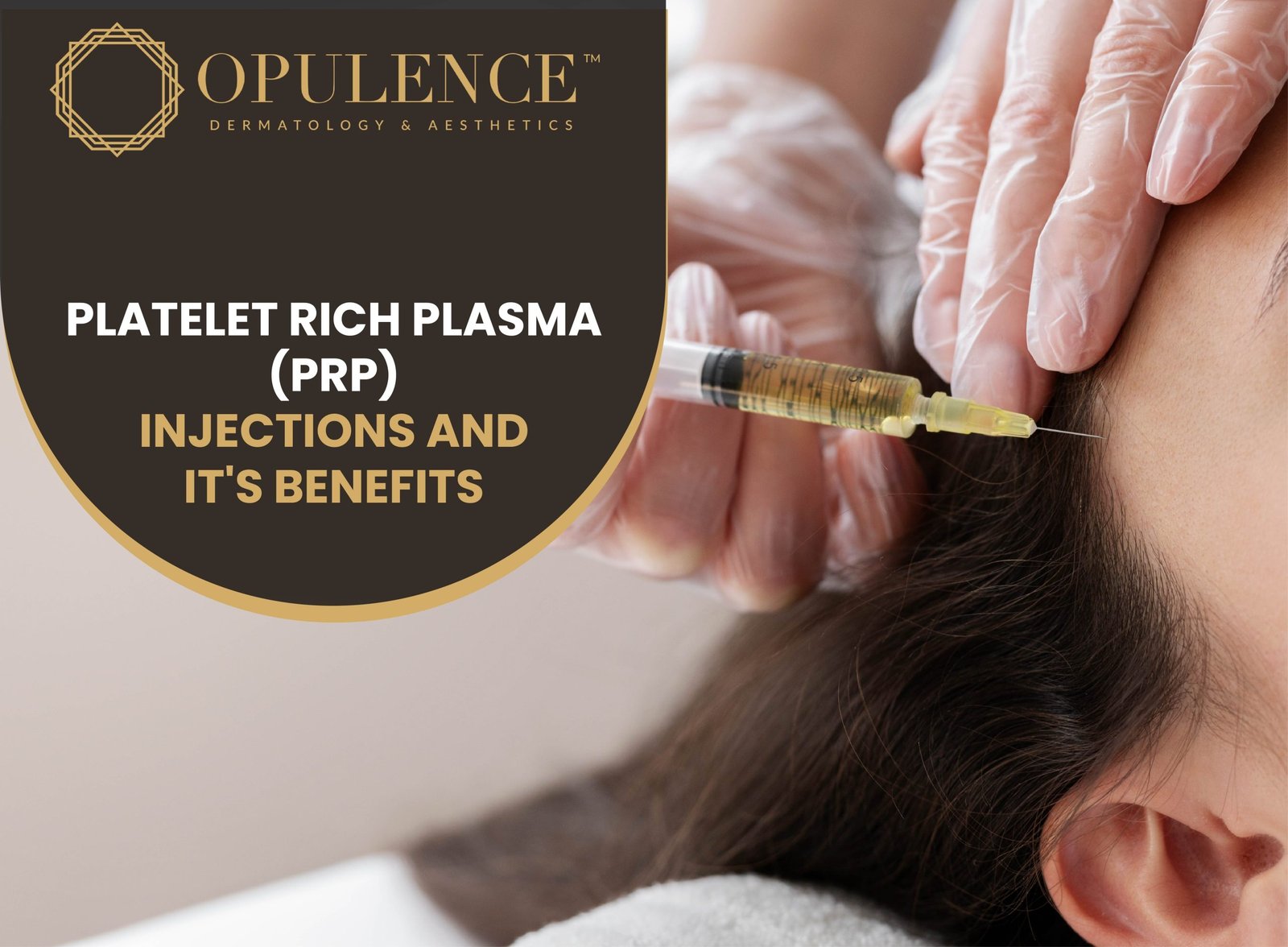 Platelet Rich Plasma (PRP) Injections and their Benefits