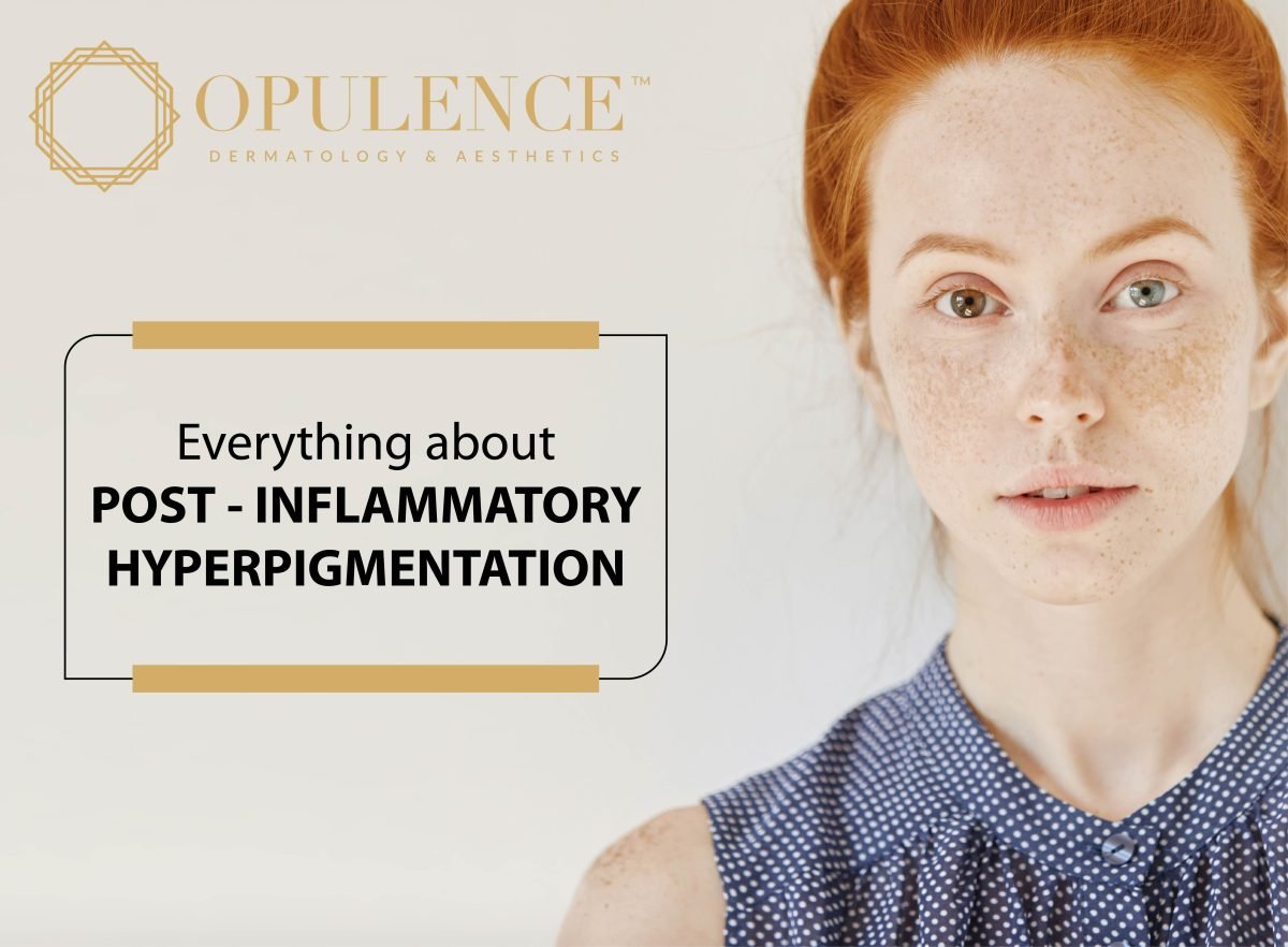 EVERYTHING ABOUT POST-INFLAMMATORY HYPER PIGMENTATION