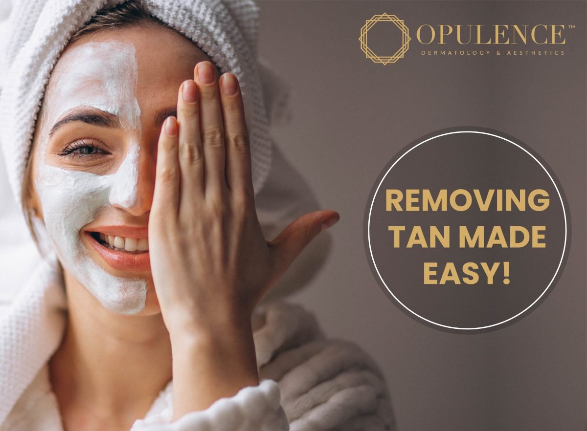 REMOVING TAN MADE EASY!